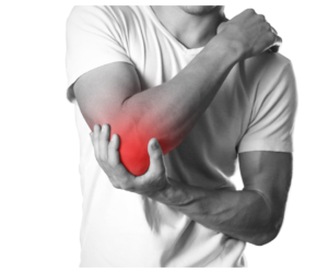 What is Bursitis?