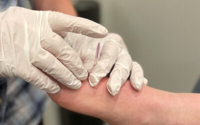 Is IMS (or Dry Needling) Right For Me?