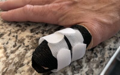 What is the Difference Between a Splint and a Brace?